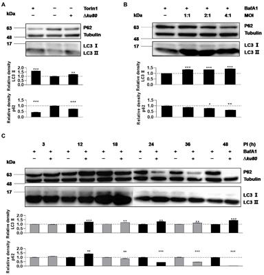 Host autophagy limits Toxoplasma gondii proliferation in the absence of IFN-γ by affecting the hijack of Rab11A-positive vesicles